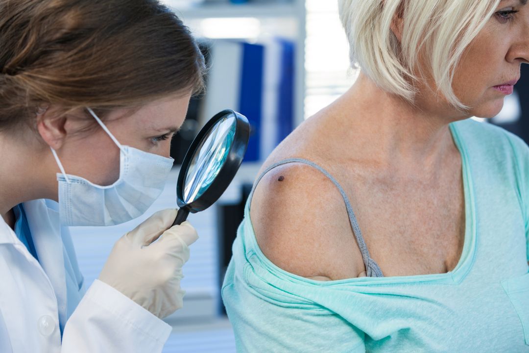 A dermatologist examining a mole on a patient's shoulder with a magnifying glass