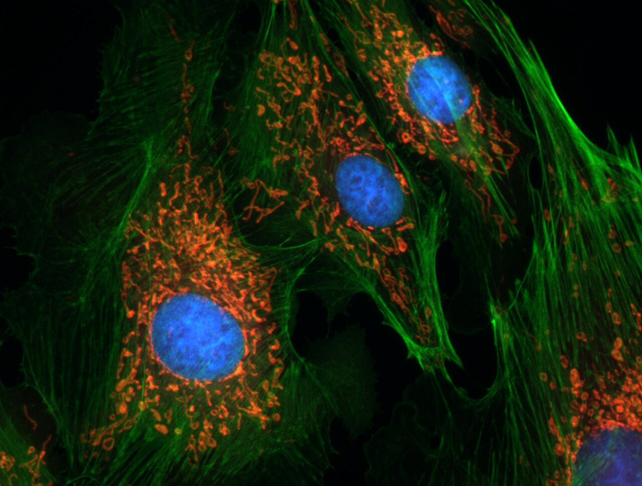 Fluorescence microscopy image of endothelial cells: blue nuclei, red mitochondria, green cytoskeleton