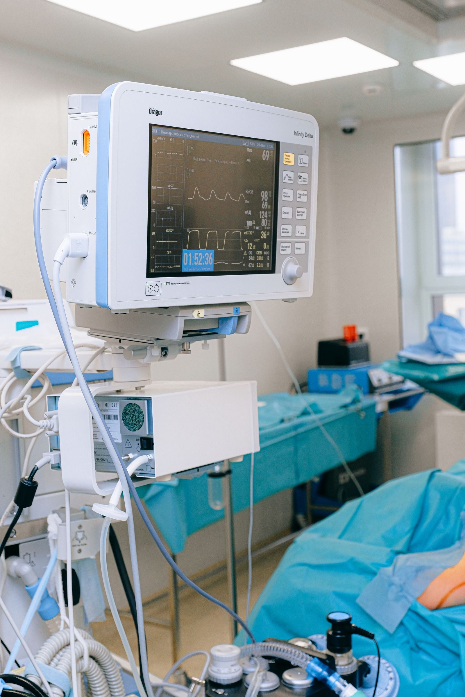 A vital-signs monitor beside a hospital bed in an intensive care unit