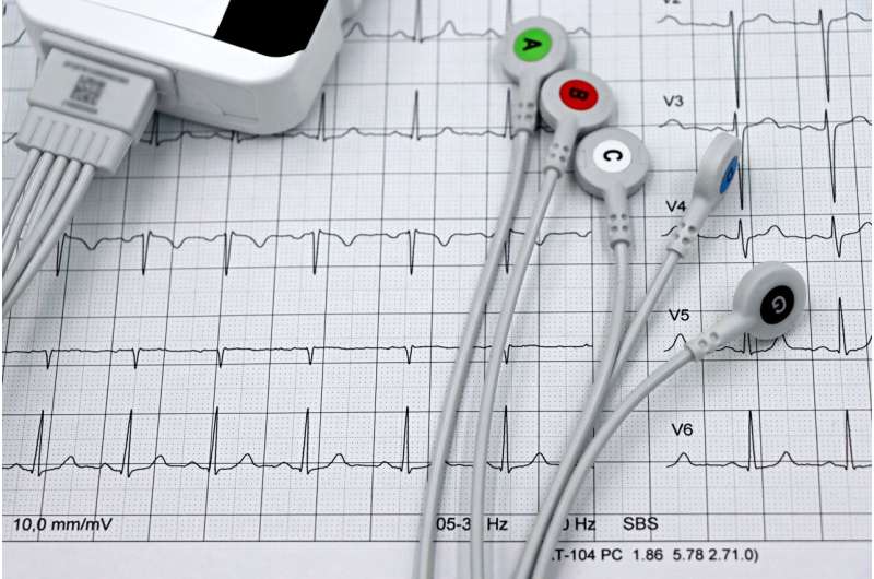 ECG electrodes resting on a printed electrocardiogram tracing